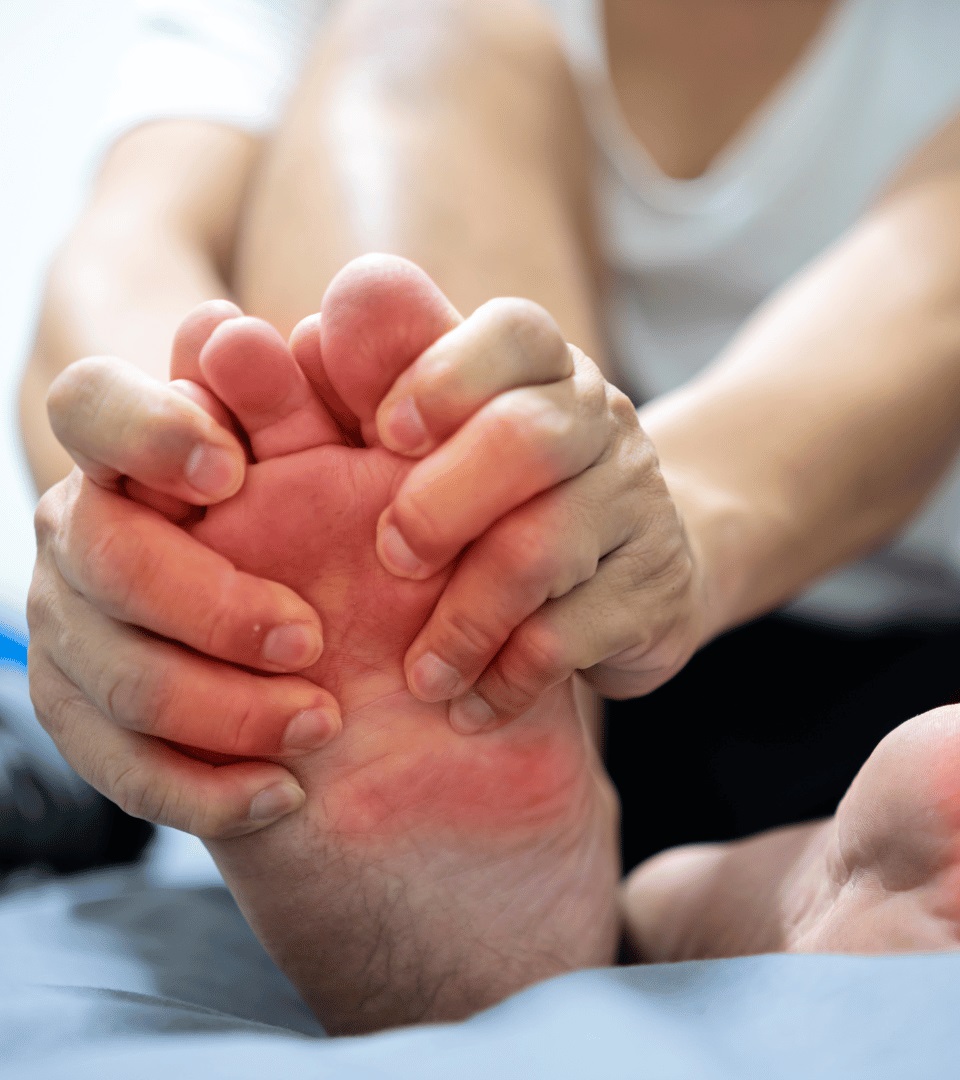 Gout Stages of Development in Noida