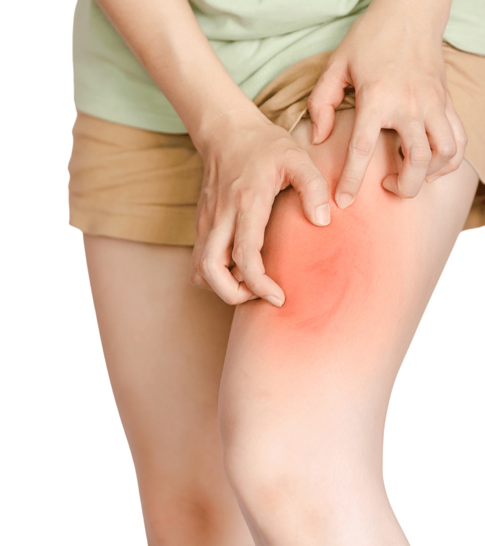 Psoriatic arthritis symptoms and causes