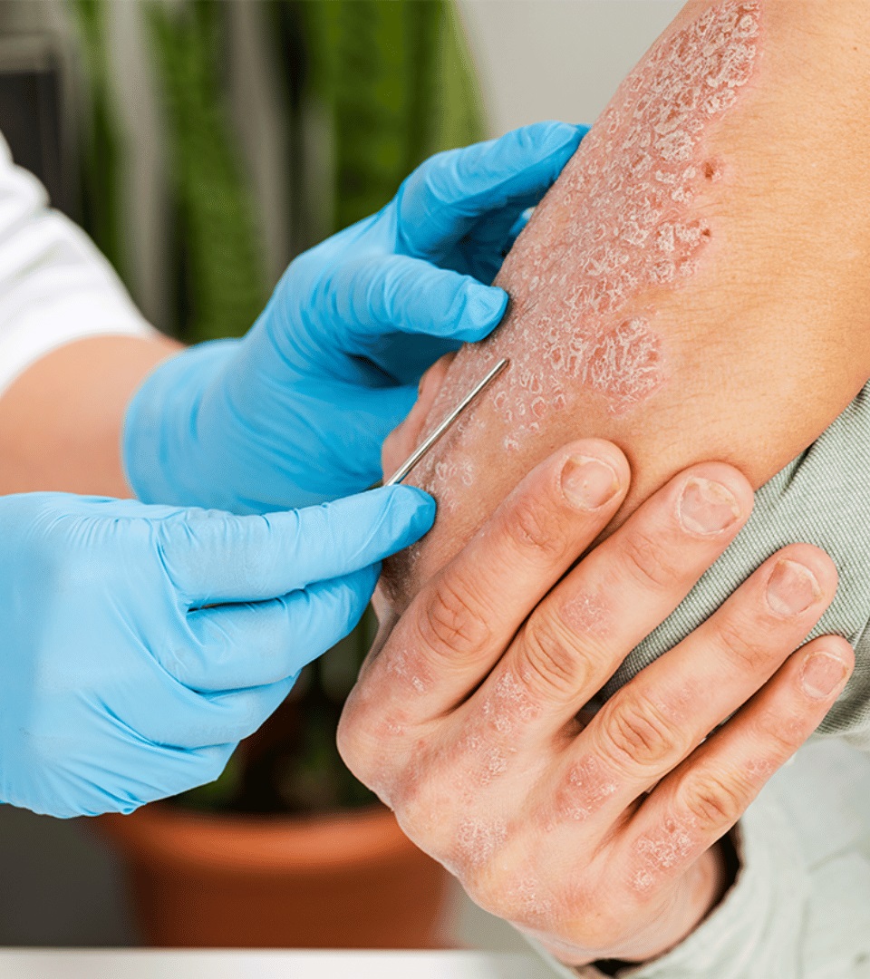 Arthritis treatment icon