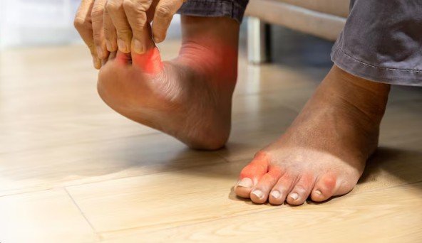 Gout Treatment in Greater Noida