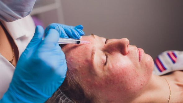 Dermatomyositis Treatment in Noida